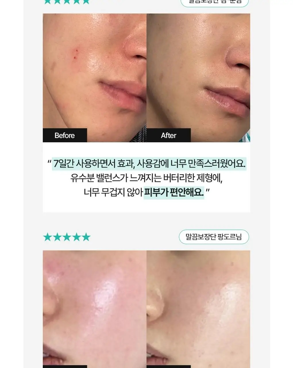 [흔적케어]브링그린 징크테카 리페어 흔적 크림 80ml (콜라보/기획) 상세페이지 10